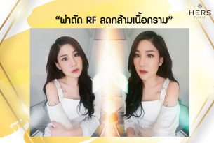 ผ่าตัดRFลดกล้ามเนื้อกราม ลดกราม บอกลาหน้าเหลี่ยม