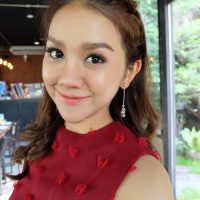 2 เดือนหลังผ่าตัดไขมันกระพุ้งแก้ม