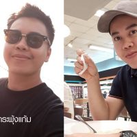 ตัดไขมันกระพุ้งแก้ม Buccal fat removal