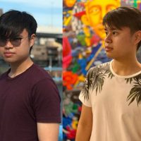 ตัดไขมันกระพุ้งแก้ม