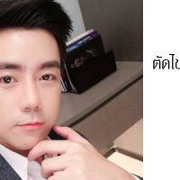 ผ่าตัดลดแก้ม
