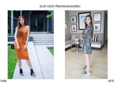 ศัลยกรรมลดน่อง ขาเรียว