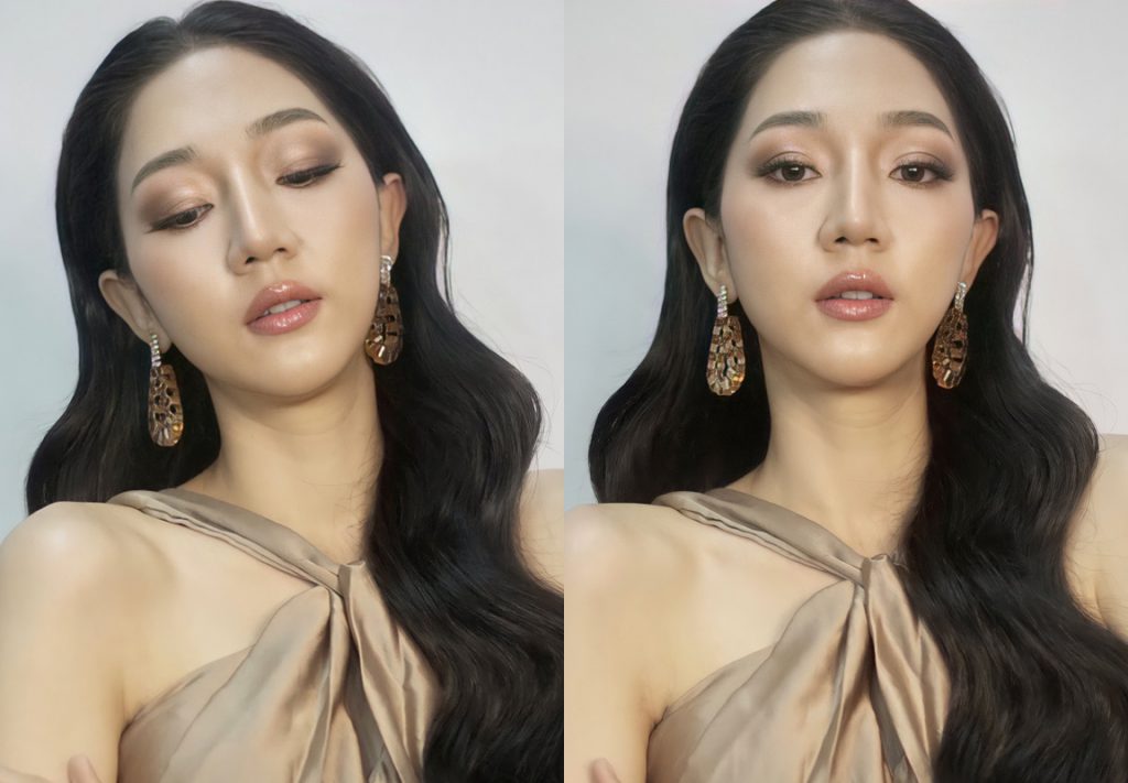 630626 รีวิว เสริมซิลิโคน หน้าผาก Hers Clinic