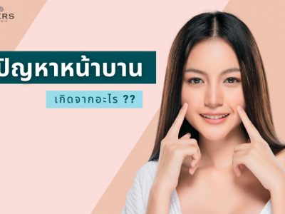 ปัญหาหน้าบาน เกิดจากอะไร