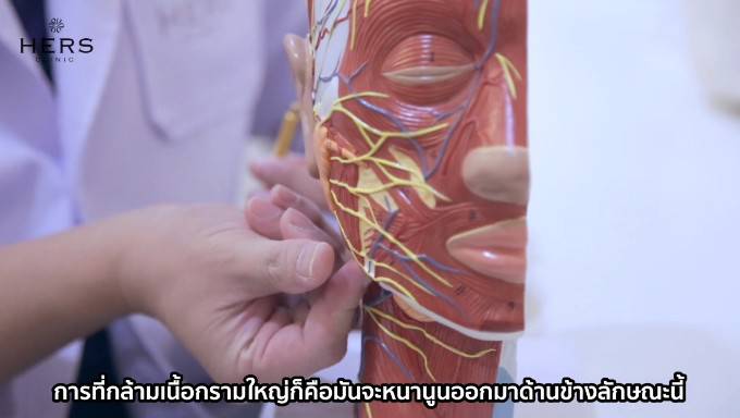การRfลดกล้ามเนื้อกราม ช่วยให้กรามดูเล็กลง