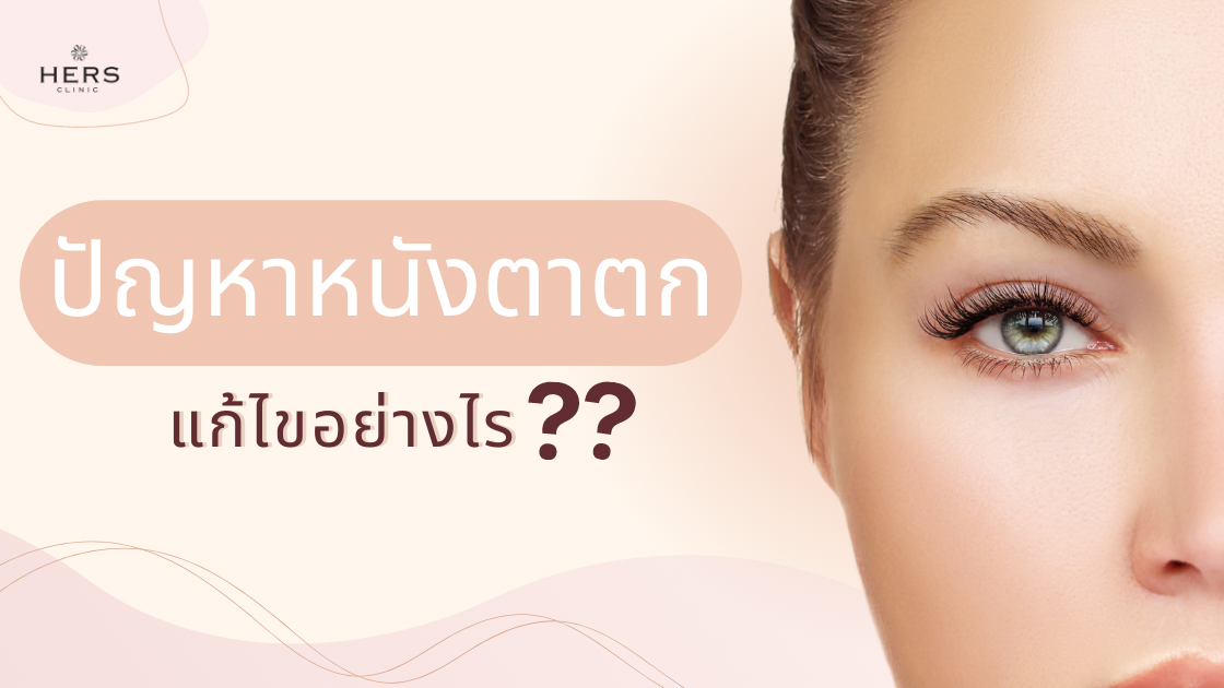 แัญหา หนังตาตก แก้ไขอย่างไร