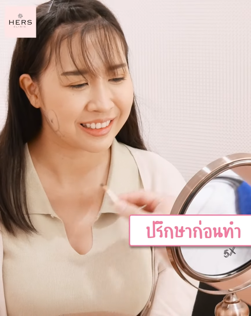 ปัญหาแก้มใหญ่ ตัดไขมันกระพุ้งแก้ม 