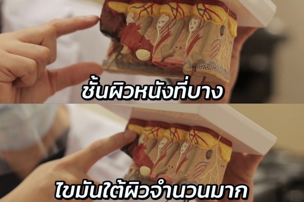 ปัญหาของเหนียงและกรอบหน้า