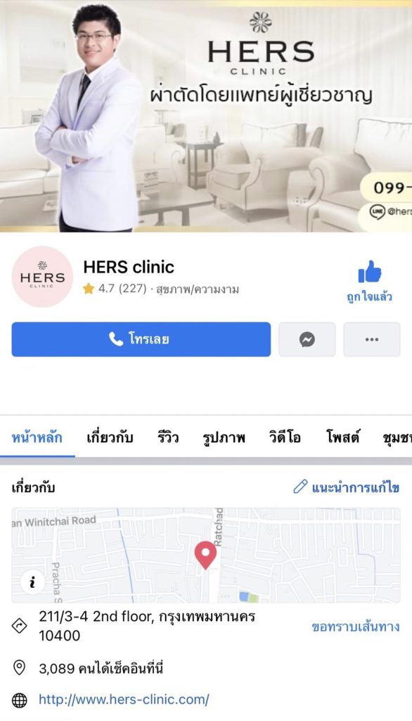 Hers clinic รีวิวผ่าตัดไขมันกระพุ้งแก้ม