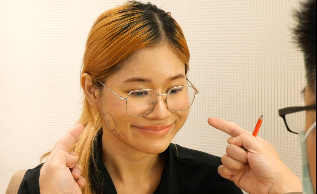 ตัดไขมันกระพุ้งแก้ม
