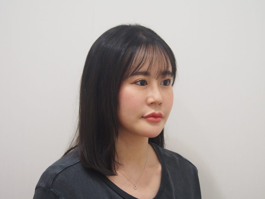 ร่องแก้มลึก